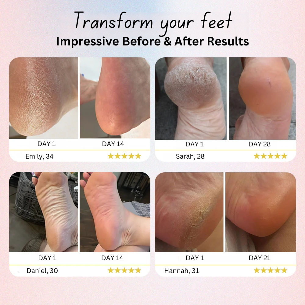 Electric Foot File
